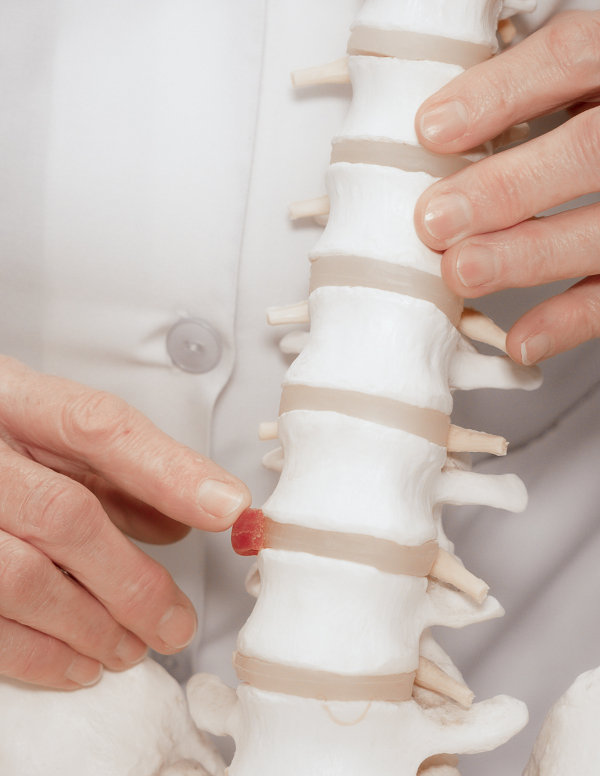 Osteopathie Beesd: zorgverzekeraar vergoedt geheel of gedeeltelijk de behandeling.